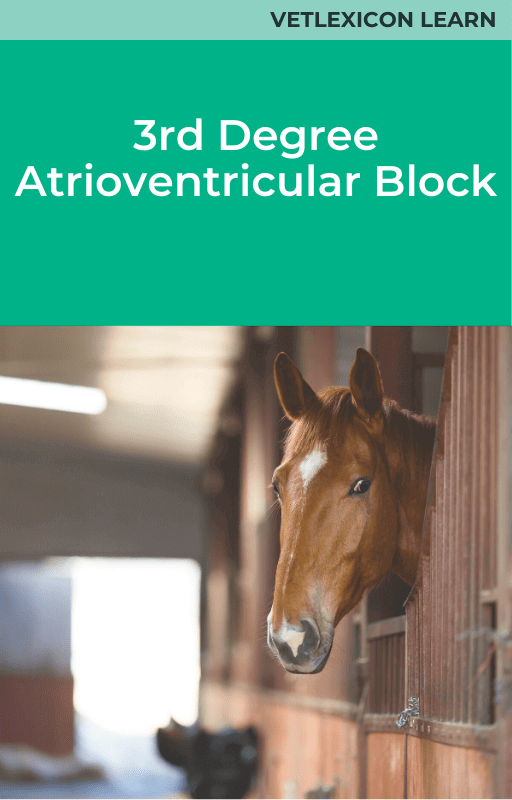 3rd Degree Atrioventricular Block